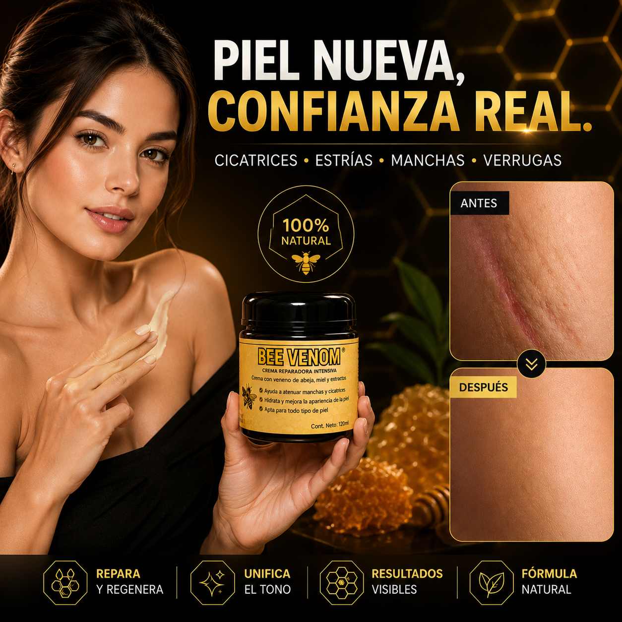 🐝 Been Venom® - Formula Americana para Estrías, Manchas, Verrugas y Marcas Difíciles